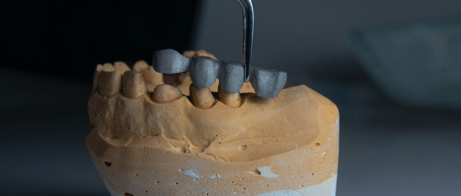 Natural Dental Anatomy