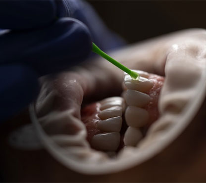 Natural Dental Anatomy