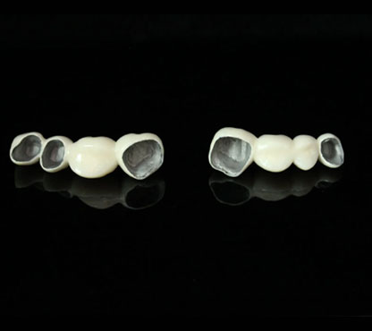 Natural Dental Anatomy