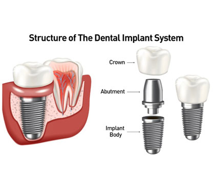 Natural Dental Anatomy